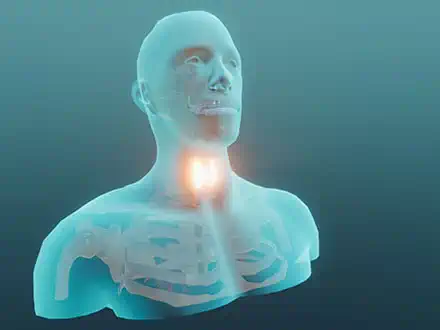 Your Neck on the Line